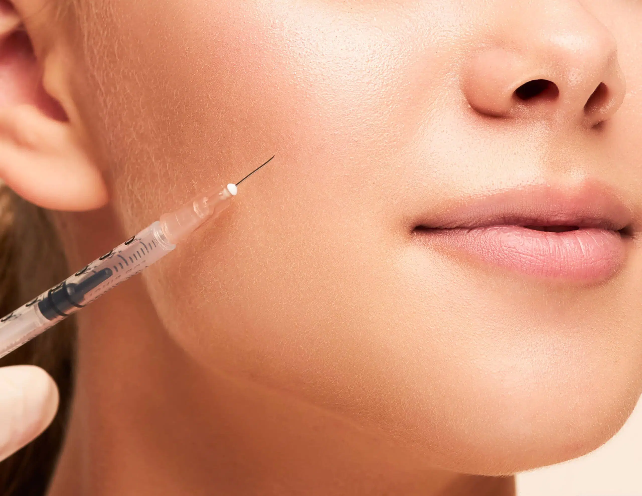 Injections d'acide hyaluronique sillons nasogéniens | Docteur Rivalier | Lyon