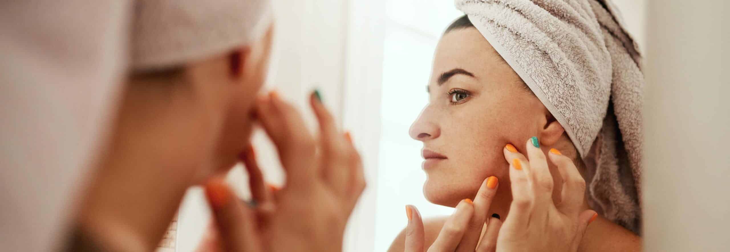 Traiter l’acné avec le peeling | Dr Rivalier | Lyon