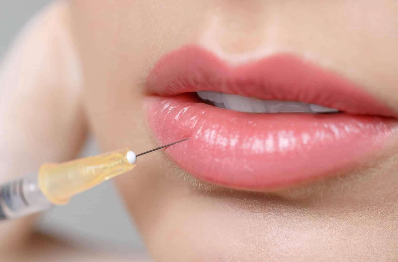 Quels résultats attendre d’une injections d’acide hyaluronique avec le Dr Rivalier à Lyon